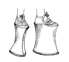 Very high platform-soled shoes worn by women throughout Italy and in northern Europe during the Renaissance; soles were especially high in Venice
