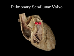 anterior and posterior pulmonary cusps