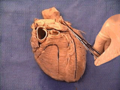 base of the heart