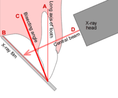 bisecting angle technique