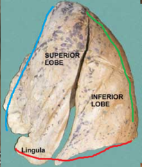 blue line = anterior border of left lung
red line = inferior border of left lung
green line = posterior border of left lung