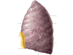 cardiac notch of left lung