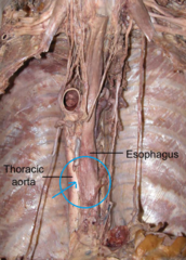 esophageal artery