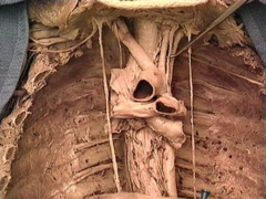 left vagus nerve (wraps around aortic arch *anteriorly*; l. recurrent laryngeal emerges posteriorly behind the arch); right vagus nerve simply wraps around subclavian artery