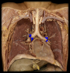 lobar bronchus (secondary) 

NOTE: be specific about location- superior, middle and inferior bronchus on right lung and superior and inferior bronchus on left lung. they go to the respective lobe
