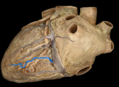 middle cardiac vein in 
in posterior interventricular sulcus