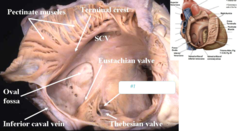 opening and valve of coronary sinus