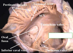 opening of the coronary sinus;
it is anterior and adjacent to opening of the IVC