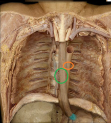 orange circle = thoracic aorta
green circle = esophagus