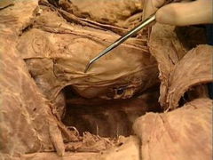 phrenic nerve, pericardiacophrenic artery and vein