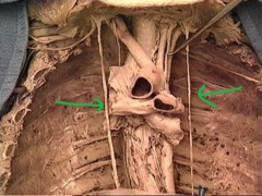 phrenic nerves 

innervate diaphragm