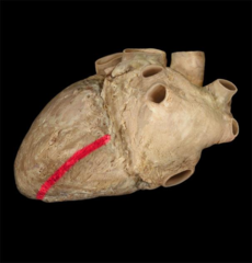 posterior interventricular sulcus 
between left and right ventricles on diaphragmatic surface