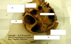 SVC opening anterior to aorta; use that as landmark

#1- SVC
#2- aorta
#3- pulmonary trunk