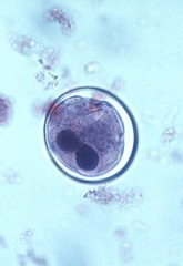 Balantidium coli cyst