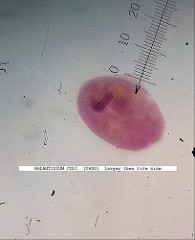 balantidium coli