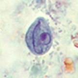 Chilomastix Mesnili cyst