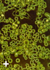 entamoeba histolytica
(+cytotoxic assay)