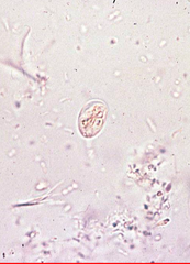 giardia lamblia
(showers of cysts and trophs)