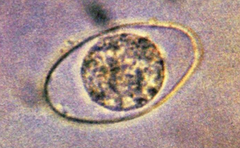 isospora belli
(oocyst)