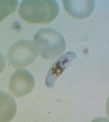 plasmodium falciparum
(gametocyte)