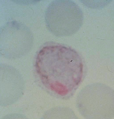 plasmodium ovale
(gametocyte)