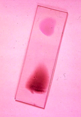 plasmodium
(thick and thin smear)