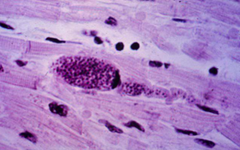 toxoplasma gondii
(cyst in muscle)