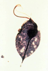 trichomonas vaginalis
(troph)